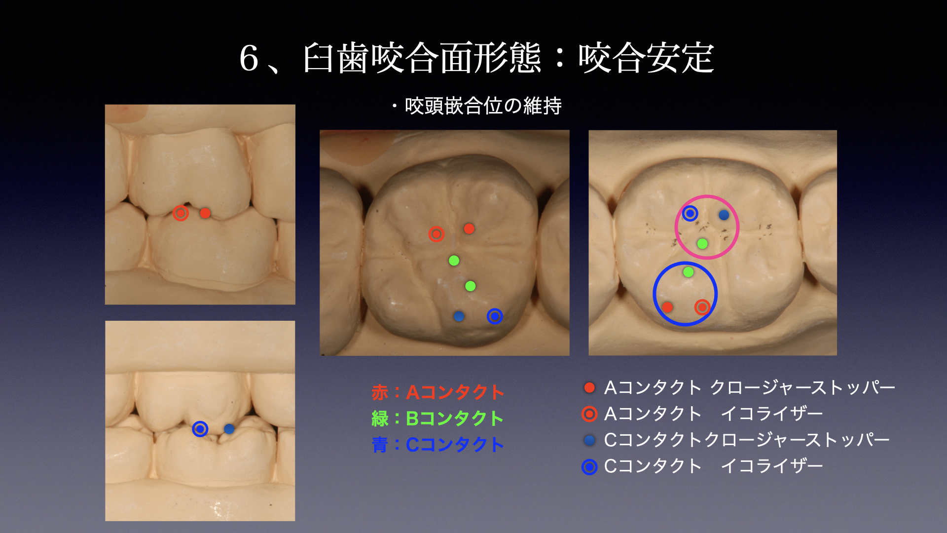 被せ物は「材料」だけでなく「形」が重要です